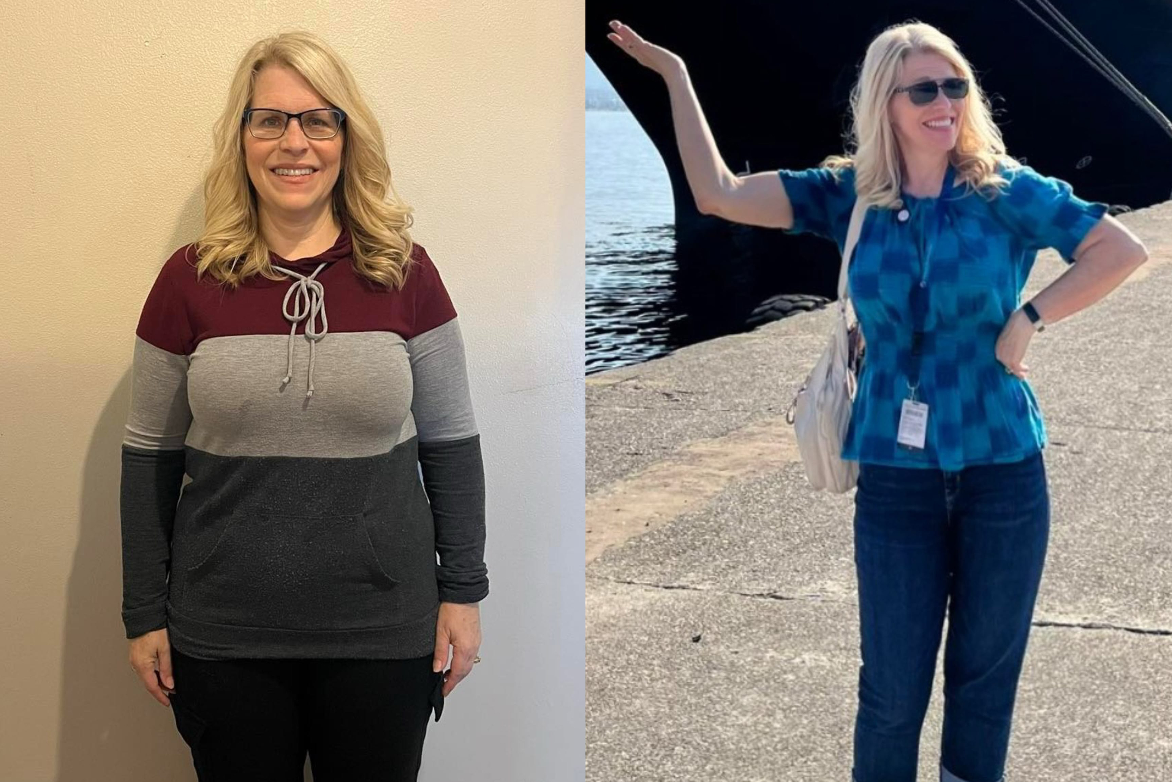 Before and after photos of a woman who received bariatric surgery